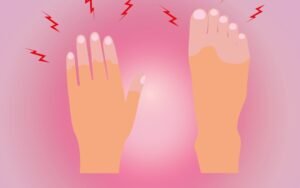 Illustration of a hand and foot with red lightning bolts showing nerve pain and tingling from hypothyroidism neuropathy