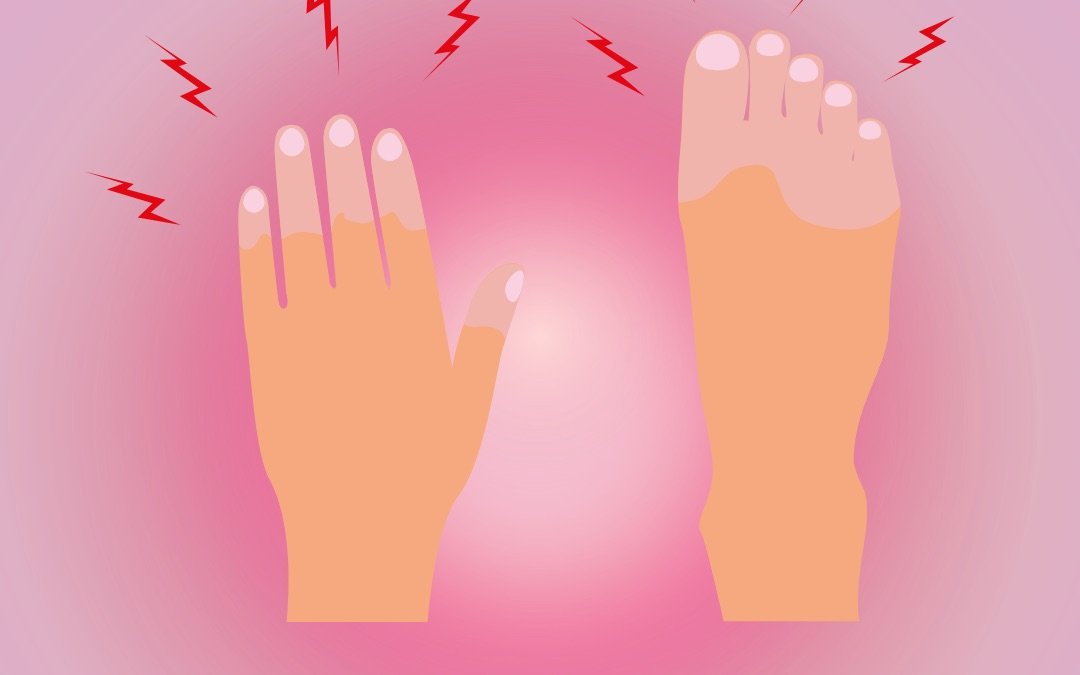 Illustration of a hand and foot with red lightning bolts showing nerve pain and tingling from hypothyroidism neuropathy